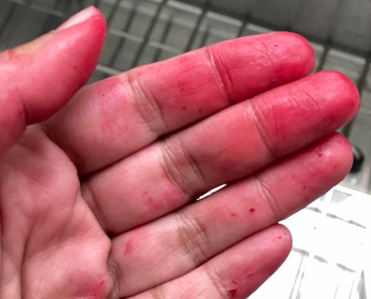 A hand with stains from peeling beets.